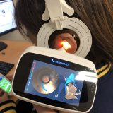 【GNリサンド 特別価格】補聴器モニター様募集いたします~3D耳型スキャナーによる耳型採取~